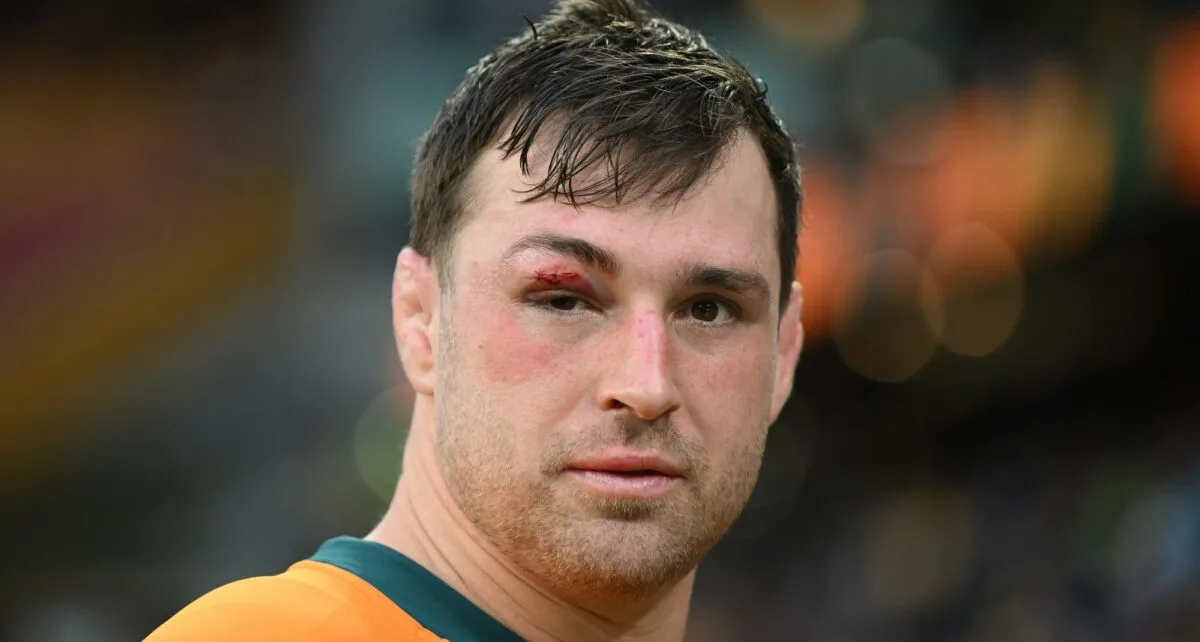 Tupou to miss Springboks rematch as Wallabies dealt triple injury blow