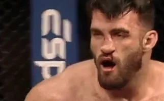 Video: Fighter resets gruesome nose break mid-fight, still loses by brutal knockout | LFA 191