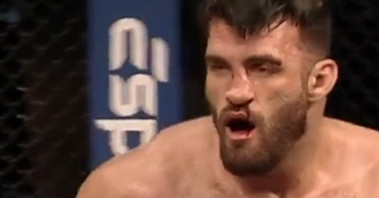 Video: Fighter resets gruesome nose break mid-fight, still loses by brutal knockout | LFA 191