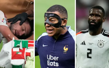 Euro 2024 injury round-up: Doubts loom over Mbappé comeback as Germany face defence trouble