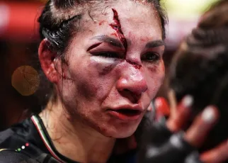 Here’s What Irene Aldana Looks Like Without Stitches Following Awful UFC Noche Face Gash