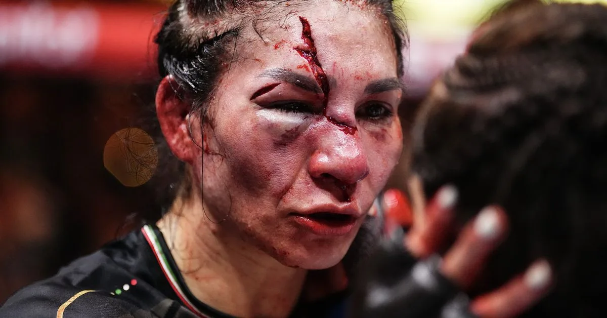 Here’s What Irene Aldana Looks Like Without Stitches Following Awful UFC Noche Face Gash