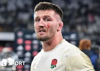 Tom Curry: England flanker on hip surgery and news career could be over