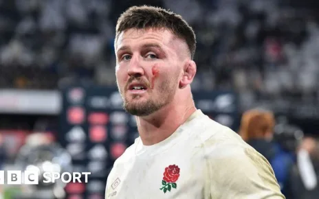 Tom Curry: England flanker on hip surgery and news career could be over