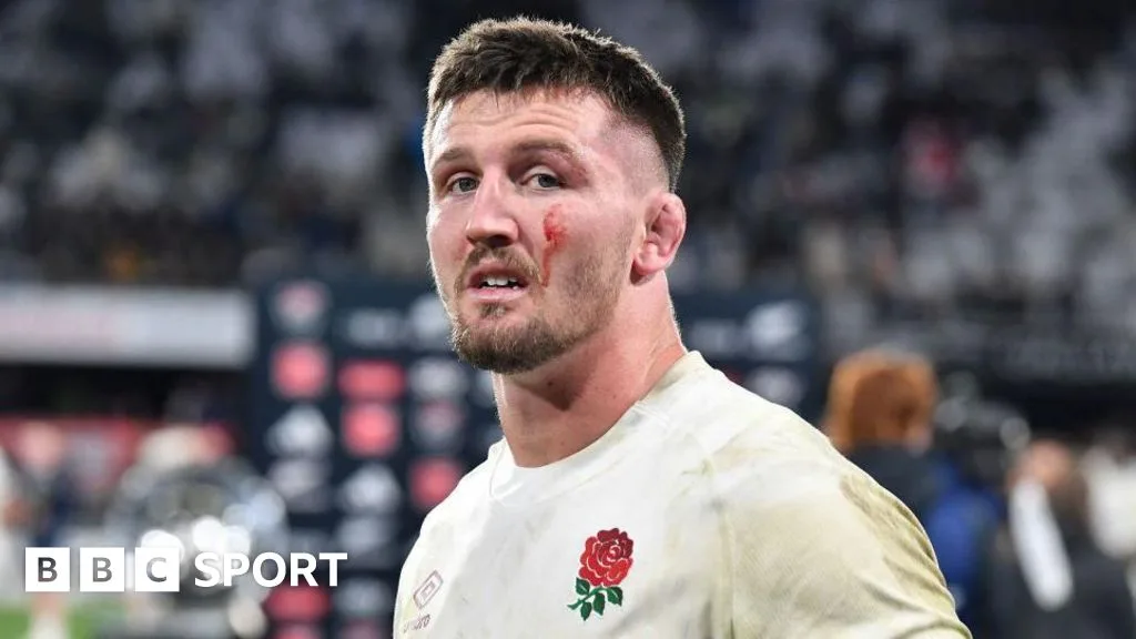 Tom Curry: England flanker on hip surgery and news career could be over