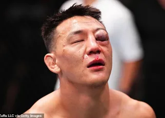 UFC fans fear Chinese star ‘might go blind’ after sustaining ‘multiple fractures’ in horror injury during brutal TKO defeat by Chris Padilla in Las Vegas