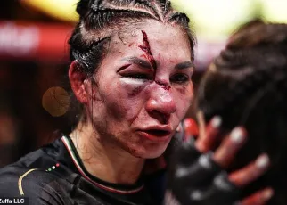 UFC fans in shock as fighter suffers HORROR facial injury in bantamweight defeat in Las Vegas: ‘Did she get hit with an axe?’