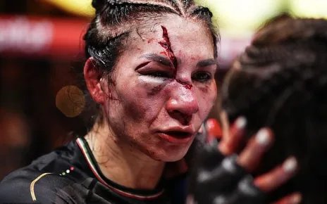 UFC fans in shock as fighter suffers HORROR facial injury in bantamweight defeat in Las Vegas: ‘Did she get hit with an axe?’