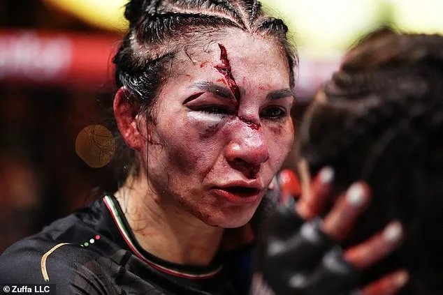 UFC fans in shock as fighter suffers HORROR facial injury in bantamweight defeat in Las Vegas: ‘Did she get hit with an axe?’