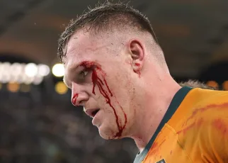 Wallabies star’s shock at Springboks’ faked injuries claims