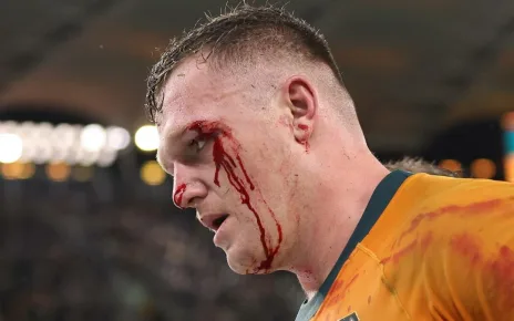 Wallabies star’s shock at Springboks’ faked injuries claims