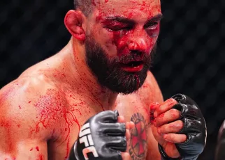 Benoit Saint-Denis Issues Statement Following Vicious UFC Paris TKO Loss: ‘This Sport Is Hard‘