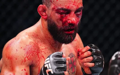 Benoit Saint-Denis Issues Statement Following Vicious UFC Paris TKO Loss: ‘This Sport Is Hard‘