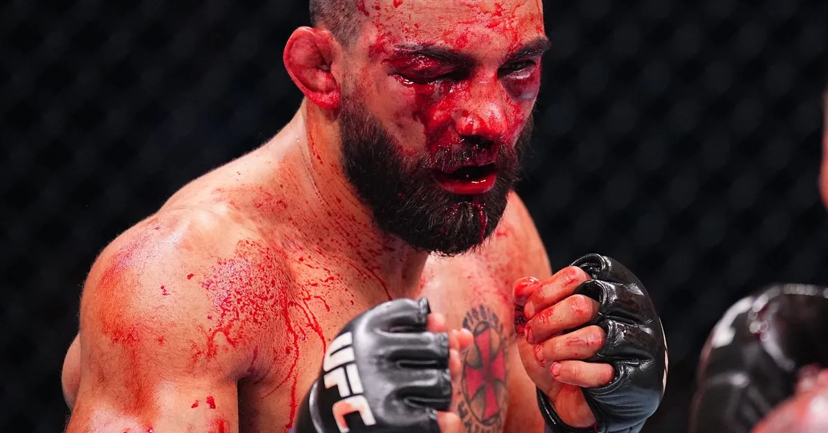 Benoit Saint-Denis Issues Statement Following Vicious UFC Paris TKO Loss: ‘This Sport Is Hard‘