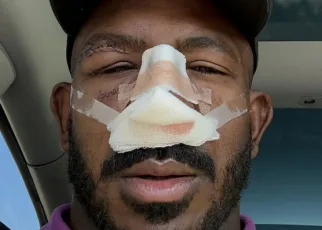 Khalil Rountree ‘May Never Be The Same’ After Facial Surgery To Repair Alex Pereira Damage From UFC 307