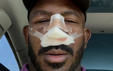 Khalil Rountree ‘May Never Be The Same’ After Facial Surgery To Repair Alex Pereira Damage From UFC 307