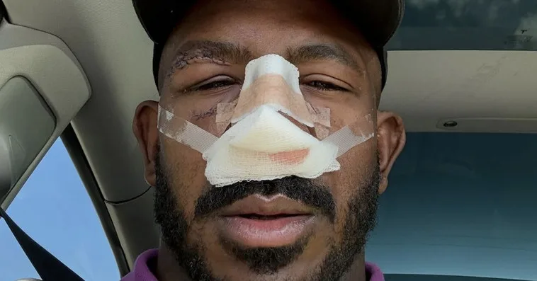 Khalil Rountree ‘May Never Be The Same’ After Facial Surgery To Repair Alex Pereira Damage From UFC 307